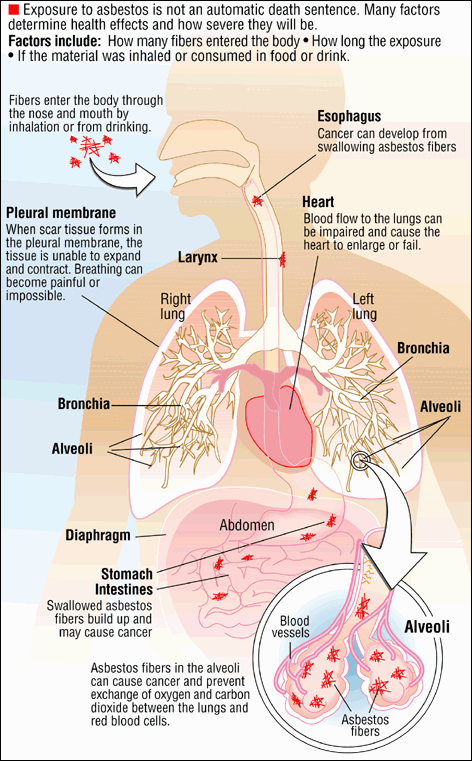 Asbestos Exposure Diagram